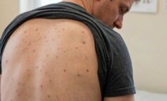 Two Bath students were at club at centre of meningitis outbreak